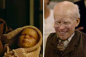 Na internet, bebê com síndrome rara é comparado ao personagem de “O Curioso Caso de Benjamin Button” | VEJA SÃO PAULO